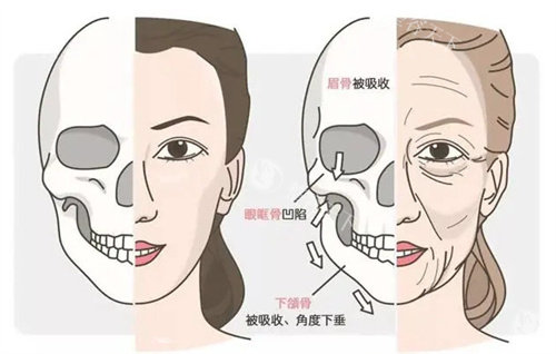 骨韧双修术整容多少钱？价格从6800元起！骨相重塑+韧带提升+三维立体抗衰！
