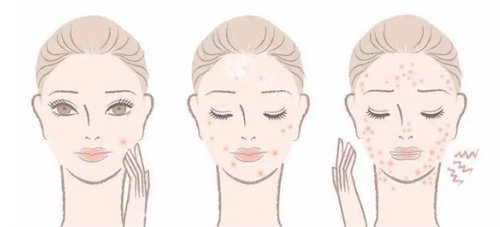 网上皮肤科免费询问24小时在线，网上整容皮肤科问题免费询问全天候在线！