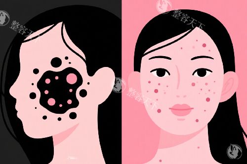 面部祛斑