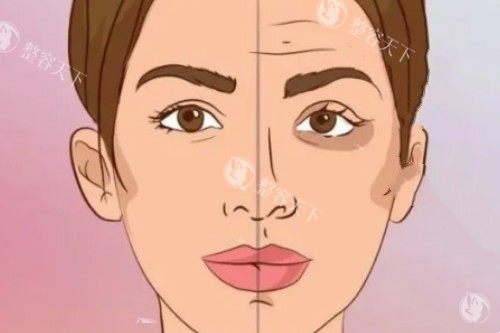 脸部做针剂提升卡通图