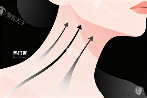 颈部做热玛吉卡通图展示