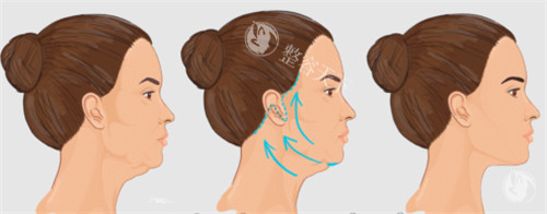 重庆军科面部提升价格大公开！30岁+必看，原来年轻5岁只需这个数