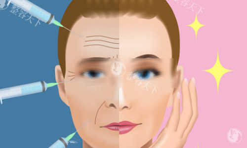 脂肪胶填充脸部能维持10年？医生揭秘5大延长秘诀，第3点90%人不知道！