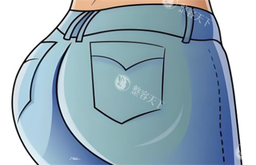 科普：假体丰臀植入层次有哪些？一文看清不同位置的优劣