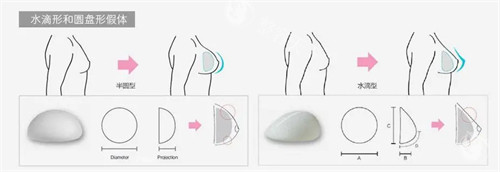 曼陀水滴VS奥若拉水滴哪个好？整形医生正规对比这两款填充材料的区别！
