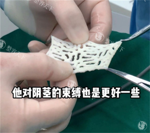 阴茎生物补片材料样子