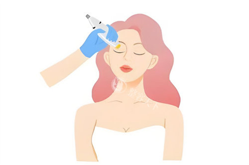 热玛吉操作图片