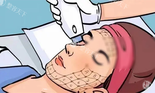 热玛吉的动画操作图