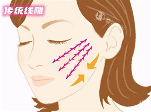 脸部提拉绷带是智商税吗？内行人实测1个月，结果震惊了