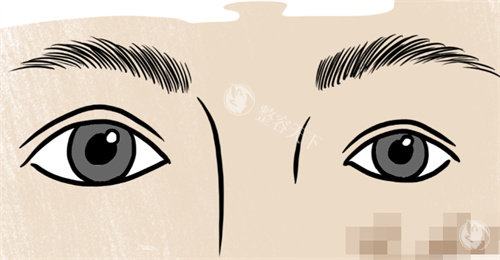 双眼皮大小眼修复