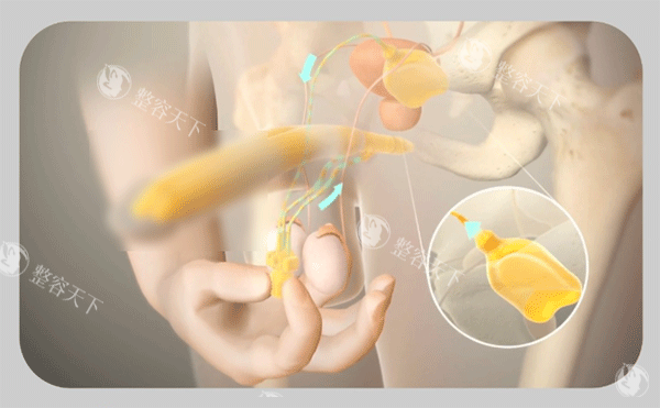 我做去势手术的经过：记录从术前焦虑到术后松弛感爆棚的心路历程！