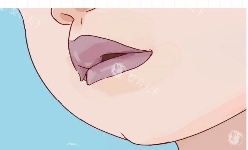 嘴唇发黑示意图