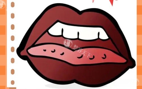 嘴唇发黑示意图1