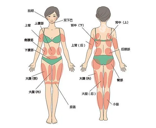 吸脂身体部位图片
