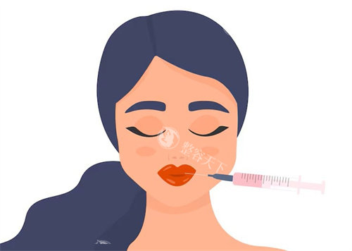 唇部注射美容