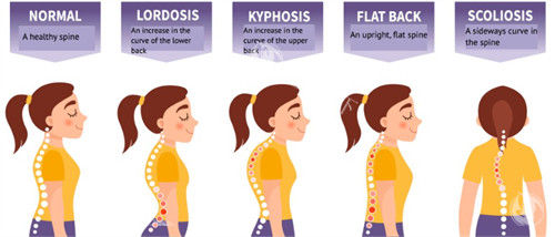 富贵包对体态的影响