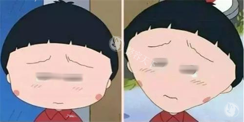 打针瘦脸前后明显对比图