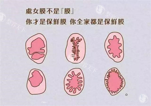 处女膜形状动画演示图