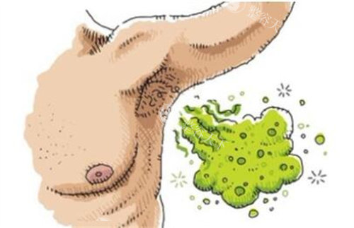 成都军建医院做腋臭是正规医院吗？正规医院专科诊疗，技术成熟创伤小，改善快结果稳超靠谱