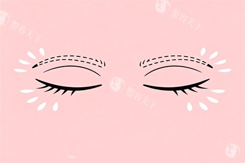 华怡张萍双眼皮做的好吗多少钱？ 20年临床经验，双眼皮技术在线，术后自然到妈生款~