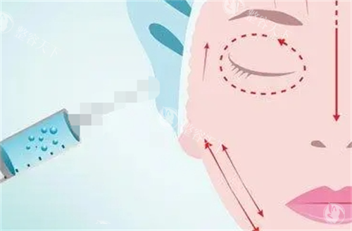 耳前韧带提升打什么玻尿酸好？选对玻尿酸的3个关键维度，新手也能秒懂