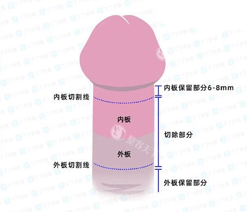 男性阴茎照片