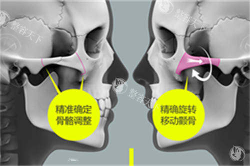 刘先超医生技术到底怎么样？网友真实评价+擅长项目大解析，选医生不踩雷！