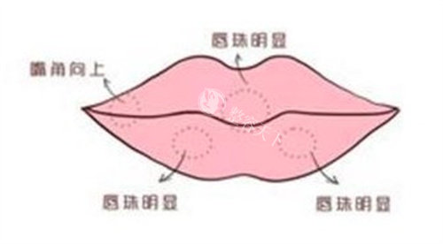 合肥华美朱晏君做唇形矫正自然吗？M 唇微笑唇定制，术后涂口红好看哭了！