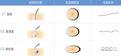 东莞植发医院排名榜新鲜出炉！very美学查东莞植发医院对比，含价格、技术、预约方式