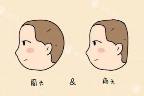 圆头扁头卡通对比图