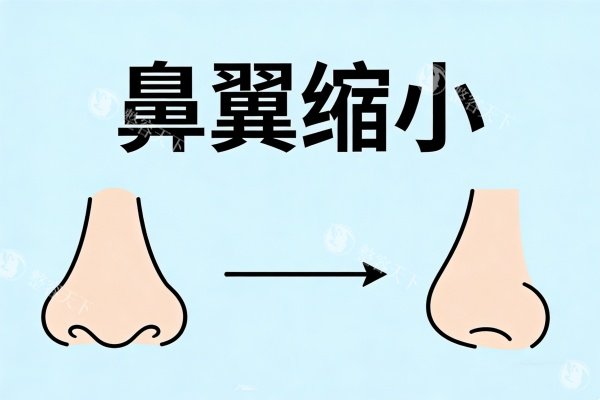 想做鼻翼缩小内切怕找不到靠谱医生？选医生难怕踩坑？Very美学小程序帮你筛选合规好医生