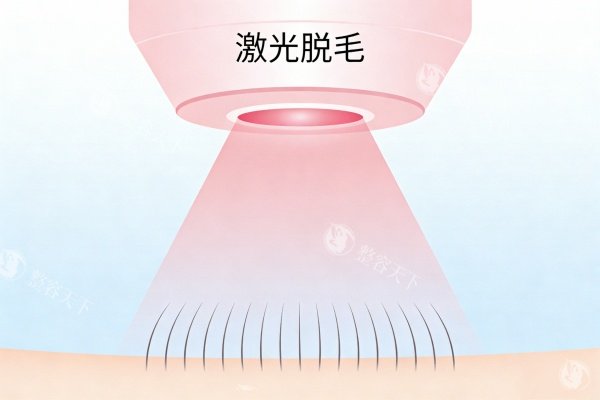 南通初颜脱毛体验怎么样？在Very美学小程序看完评价后，我决定尝试一次并记录全过程！