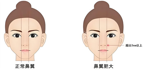 想找王晖做缩鼻翼？very 美学小程序带你轻松走完预约流程！