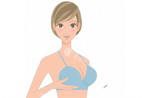 美波婷无痕幼态胸好不好？技术原理加成效深度解析，适应人群+费用+口碑一次讲清楚！