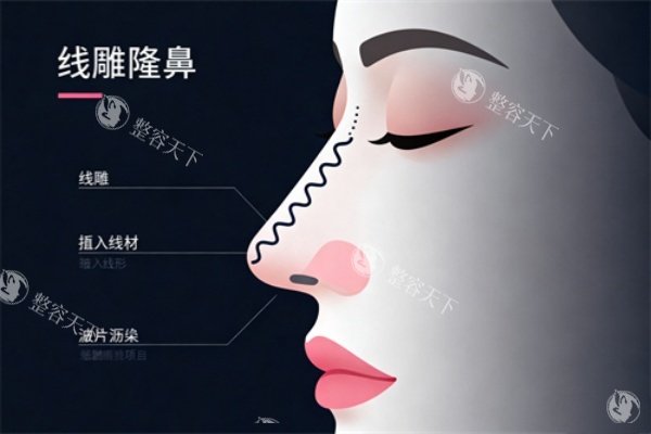 西安叶子整形医院做鼻综合价格贵吗？有没有隐形消费？求避坑指南！