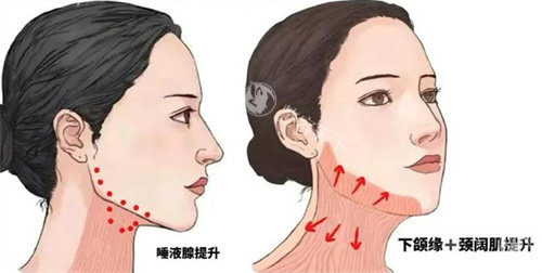 做颌面/整形功课刷到宋立男和王香平，有没有姐妹说下宋立男和王香平谁更强呀