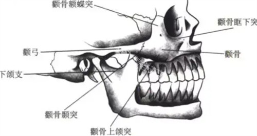 做完颧弓内推之后发现骨缝变大太焦虑？过来人整理了靠谱解决方法给你们参考