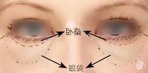 眼周组织图