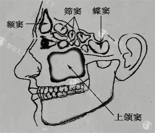 笑起来总是露牙龈特别不上镜，露牙龈是骨性凸嘴吗？想矫正先搞懂这些再决定