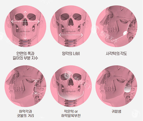 韩国高人气整形医生郑钟必会不会来我国坐诊？想面诊的别跑空了