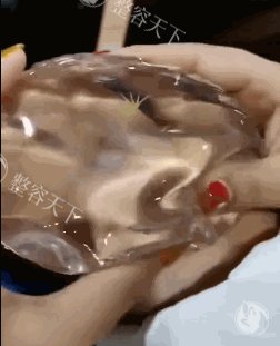 隆胸之后发现隆胸两侧腔体开刀大小不一样，会不会有问题？需要二次修复吗？过来人给你说答案