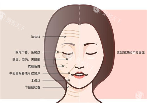 面部抗衰前后