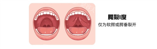 腭裂二次修复能报销吗？病友妈妈们总结的真实成功攻略，Very美学可查不白跑