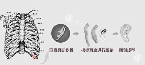 上海张天宇医生耳再造预约挂号教程！分阶段流程，一期二期手术可同步面诊询问医师方案~