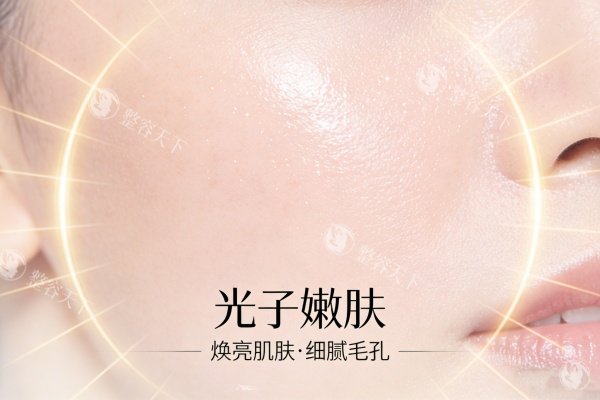 光子嫩肤作用卡通图展示.jpg