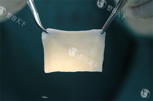 贵阳阴茎增粗多少钱？2026价格表：自体脂肪6000起+生物补片1万—2.5万起，预算这么选！