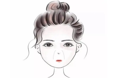 为什么感觉韩国做的鼻子都露鼻孔，是技术特点还是审美差异？