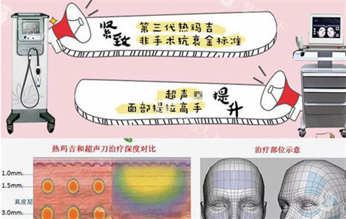 热玛吉与超声仪器抗衰的作用图解.jpg