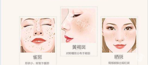 珠海激光祛斑医院哪家好？告别“花脸”困扰，看这几家如何实现精细净斑