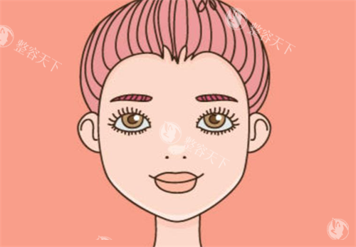 双眼皮手术经过
